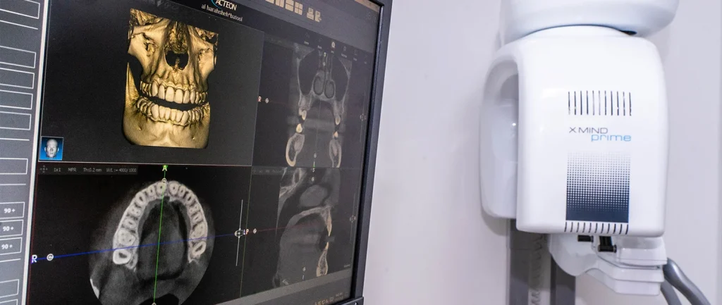 التشخيص-والتصوير-الإشعاعي2-1-1