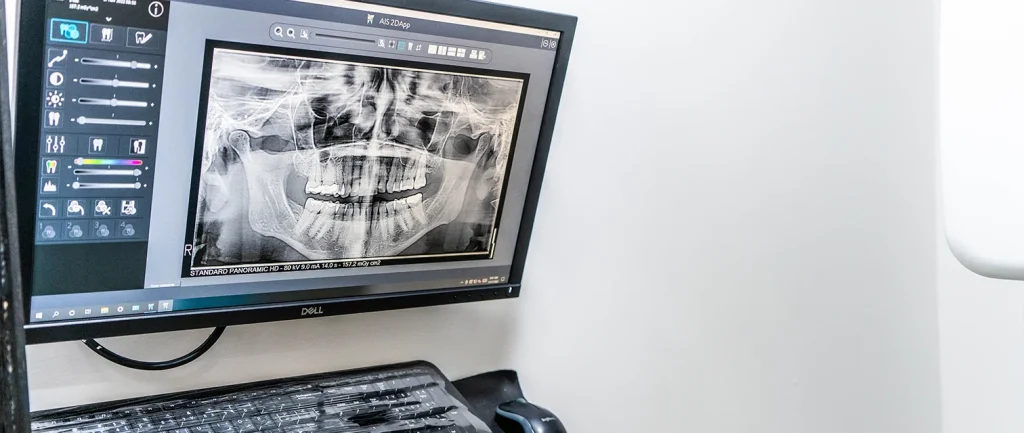 التشخيص-والتصوير-الإشعاعي3-1